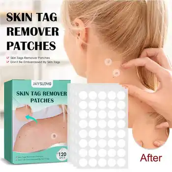 120pcs/caixa Pele Tag Remover o Patch de Tratamento do Wart Adesivos Absorver Gesso Hidrocolóide Gel Anti-infecção Invisível Cuidados com a Pele