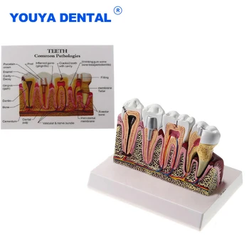 Anatômico Padrão Dental Oral Dentes Modelo De Ensino Abrangente Da Estrutura Do Dente O Dentista Dental Manifestação Estudantil